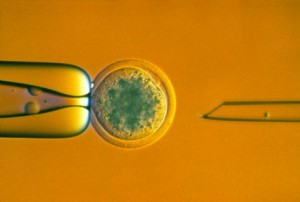 LM of an egg before DNA removal for sheep cloning