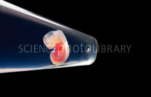 Natal long-fingered bat embryo