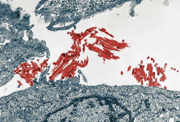The H1N1 flu virus (red) is pictured in this handout photograph taken on July 9, 2009 and released on July 13, 2009. The new H1N1 influenza virus bears a disturbing resemblance to the virus strain that caused the 1918 flu pandemic, with a greater ability to infect the lungs than common seasonal flu viruses, researchers reported Monday. REUTERS/Image courtesy of Yoshihiro Kawaoka/University of Wisconsin-Madiso/Handout (UNITED STATES SCI TECH HEALTH IMAGES OF THE DAY) FOR EDITORIAL USE ONLY. NOT FOR SALE FOR MARKETING OR ADVERTISING CAMPAIGNS
