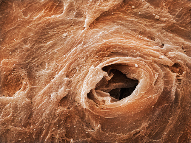 Human sweat pore. Coloured scanning electron micrograph (SEM) of a sweat pore on a human hand. Sweat is released through holes like this onto the surface of the skin from glands below the surface. The sweat evaporates, and this cools the body by carrying away heat. The surrounding area shows the dead cells making up the surface layer of the skin, the stratum corneum. The oily exudate from these pores, left behind on a surface, is what we see as finger prints. Field of view (horizontal field width) 64um.