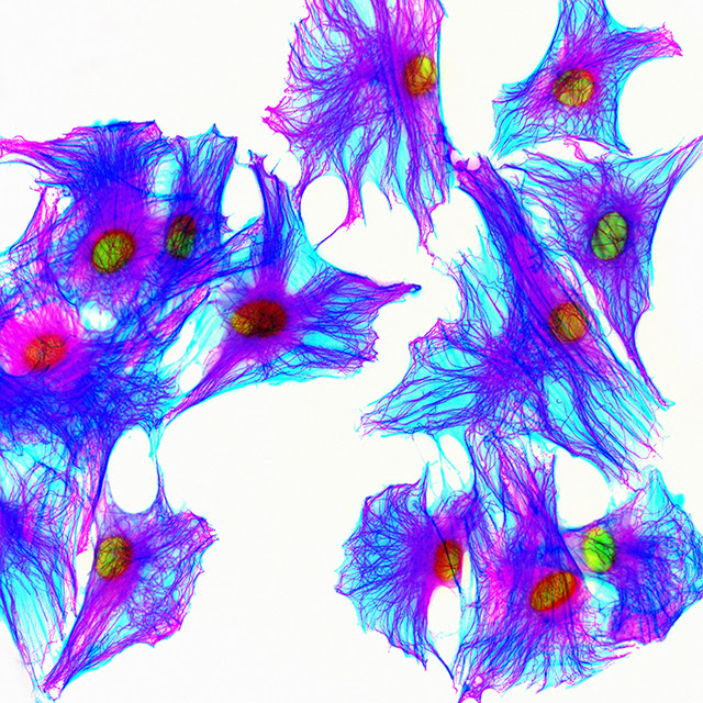 Kevin Mackenzie / UNIVERSITY OF ABERDEEN / SCIENCE PHOTO LIBRARY