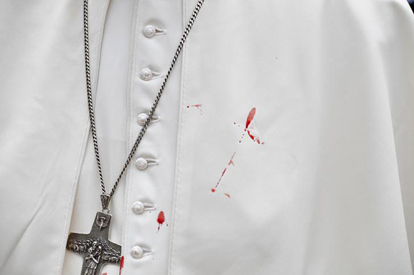 A few droplets of blood stain Pope Francis' white tunic from a bruise around his left eye and eyebrow caused by an accidental hit against the popemobile's window glass while visiting the old sector of Cartagena, Colombia, on September 10, 2017.REUTERS/Alberto PIZZOLI/Pool TPX IMAGES OF THE DAY
