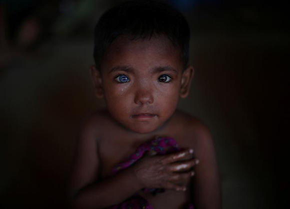  Hosne Ara, 4, a Rohingya refugee who fled Myanmar two months ago, listens to children singing at a children's centre in the Kutupalong refugee camp near Cox's Bazar, Bangladesh. Photo by Hannah McKay 